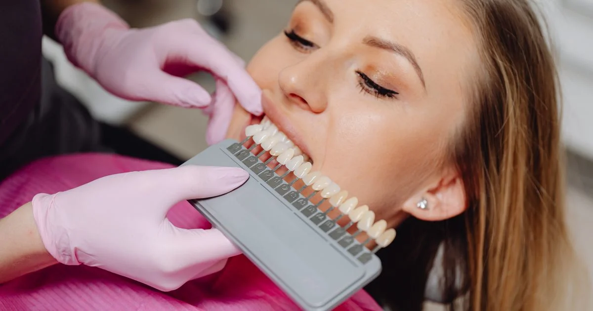 A dental shade guide held against a smile to match tooth color, the measurement a cheap teeth whitening kit under $30 is judged by